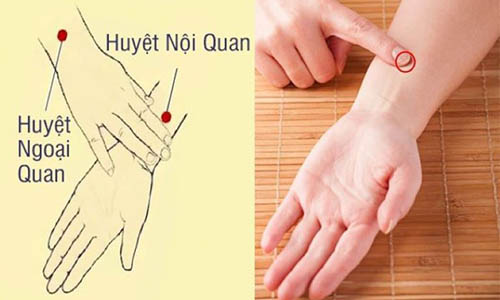 Huyệt nội quan