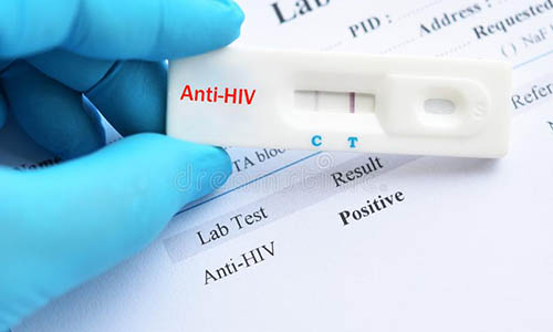 Xét nghiệm HIV