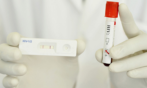 Xét nghiệm HIV