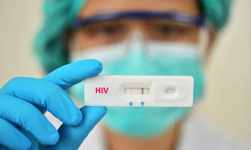 Cần nên xét nghiệm HIV